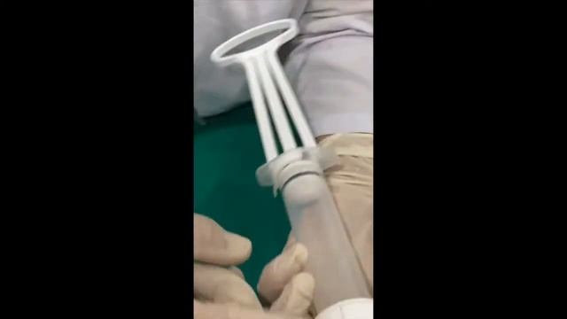 Manual vacum aspiration смотреть онлайн