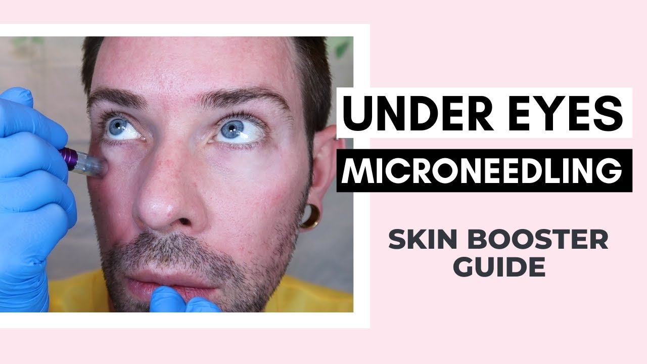 How To Microneedle Under Eye With PDRN Skin Booster | Curenex With Dr Pen Ft @Vanidiy смотреть онлайн