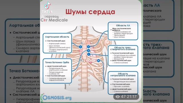 Медицина: Шумы сердца/16.10.21 смотреть онлайн