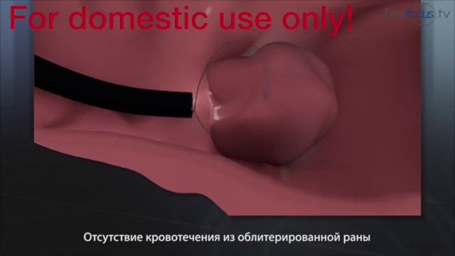Gastroskopie russische Version смотреть онлайн