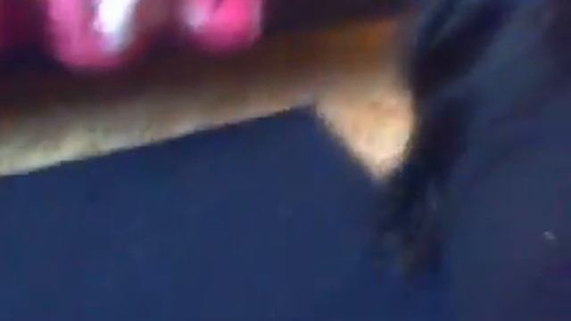 второй день с ожогом. пытаюсь одеться :D смотреть онлайн