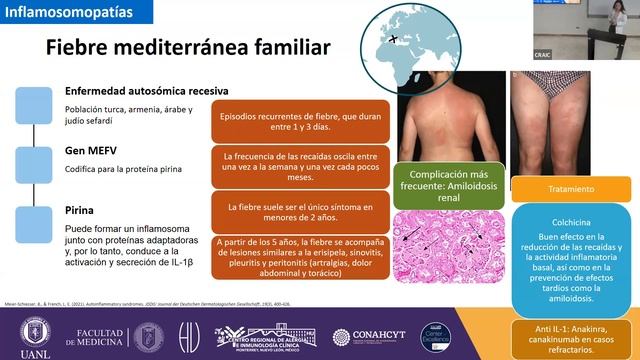 Caso clínico de inmunología смотреть онлайн