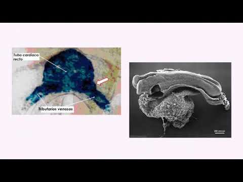 Cardiogénesis humana1 смотреть онлайн