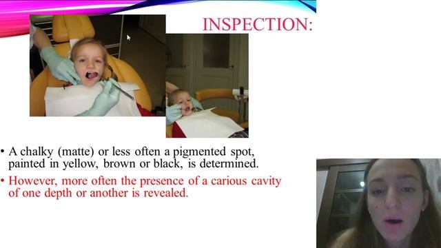 Caries of deciduous teeth Clinic, diagnostics, differential diagnostics смотреть онлайн