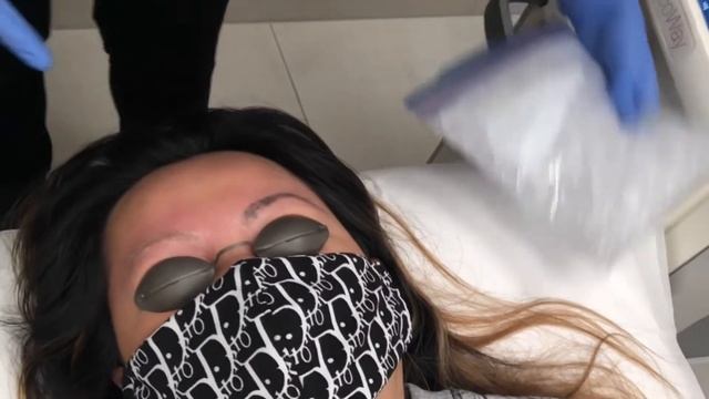 Getting Laser Tattoo Removal on My Eyebrows! смотреть онлайн