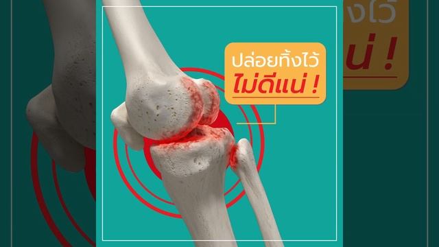 UC-CAL ไขข้อดี หนี ข้อเสื่อม смотреть онлайн