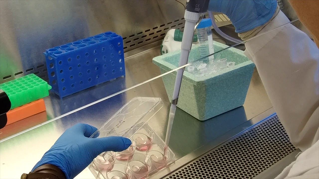 Cancer researcher Semir Beyaz – a CSHL PI profile смотреть онлайн