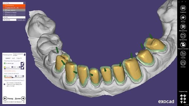Виниры Exocad:2)Создание мин. толщины и цементного зазора в Exocad / Veneers Exocad:2) Crown Bottom смотреть онлайн