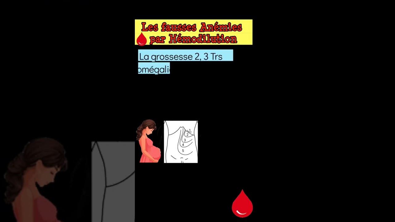diagnostics différentiels de l'anémie: les 4 Causses des Fausses Anémies par Hémodilution смотреть онлайн
