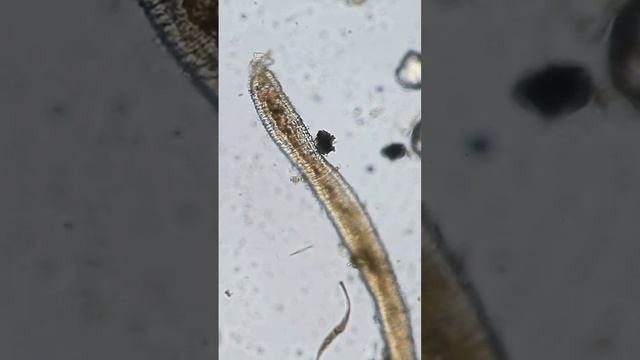PREDATOR vs. Worm under the Microscope #biology #microscope #science смотреть онлайн