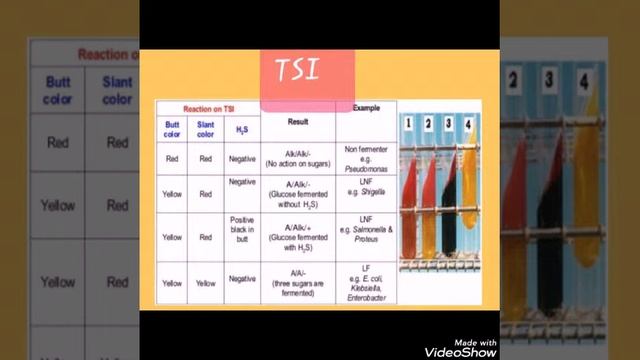 Microbiology 🔤 - Biochemical Tests and Identification of Enterobacteriaceae смотреть онлайн