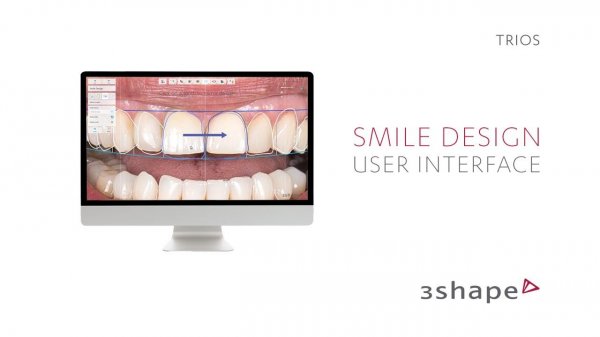3Shape - Smile Design User Interface