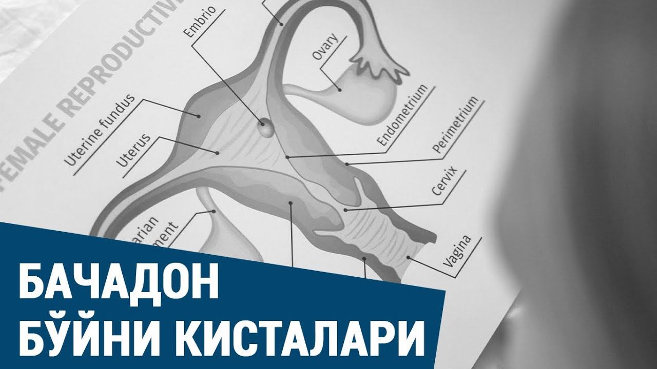 Бачадон бўйни кисталари: сабаблари, белгилари, аниқлаш ва даволаш смотреть онлайн