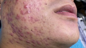 Relax Every Day With Sac Dep Spa #0404