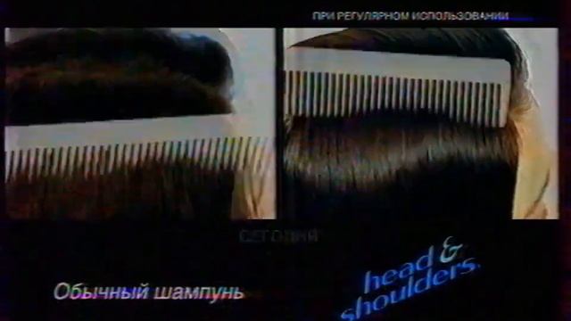 Head&Shoulders ОРТ 04 09 2001 смотреть онлайн