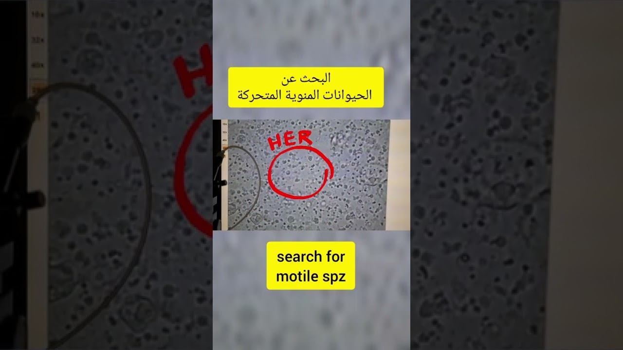 Cryptozoospermia #semenanalysis #pma #fiv #azoospermia #icsi #ivf #embryology #اطفال_الأنابيب смотреть онлайн
