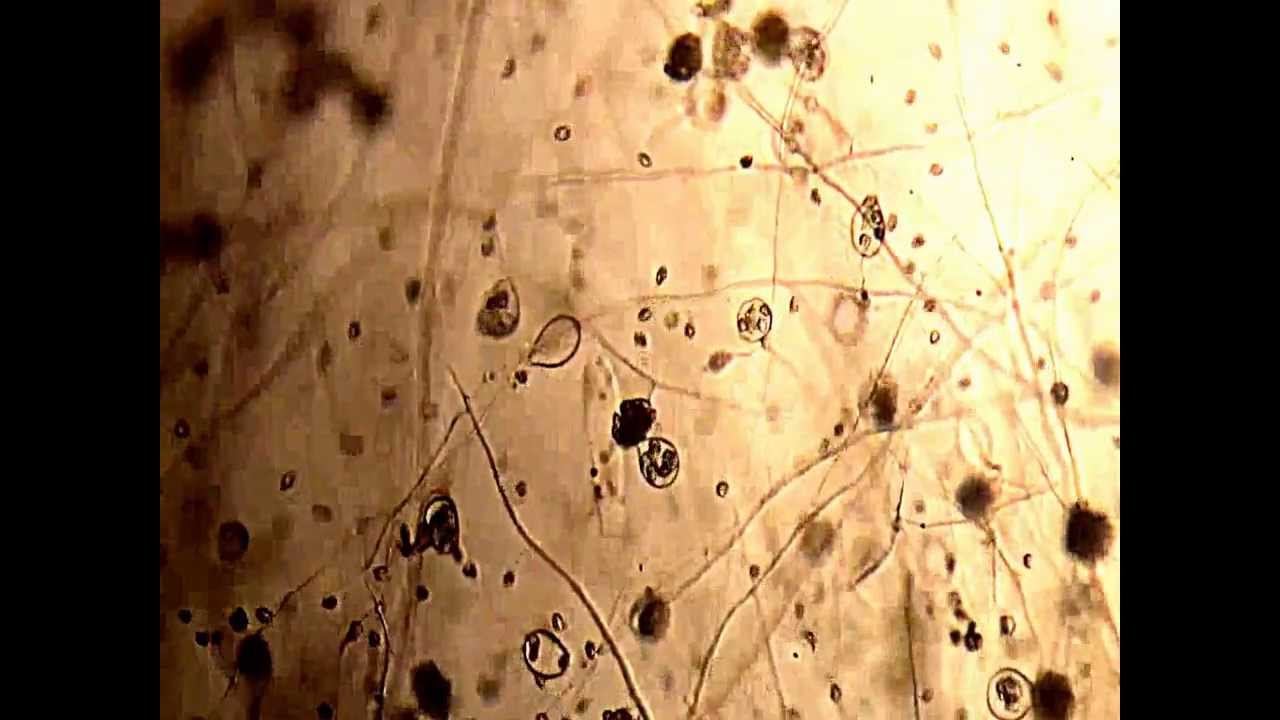 Copy of Zoospore release at Biotechnology lab BSMRAU смотреть онлайн