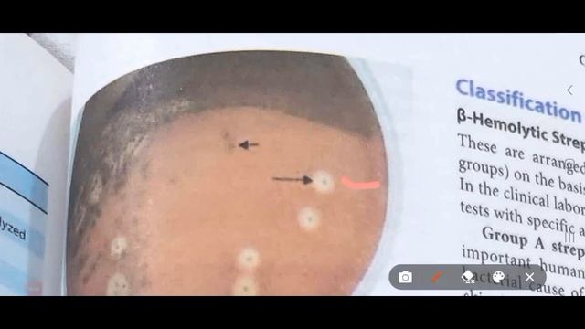 STREPTOCOCCUS смотреть онлайн