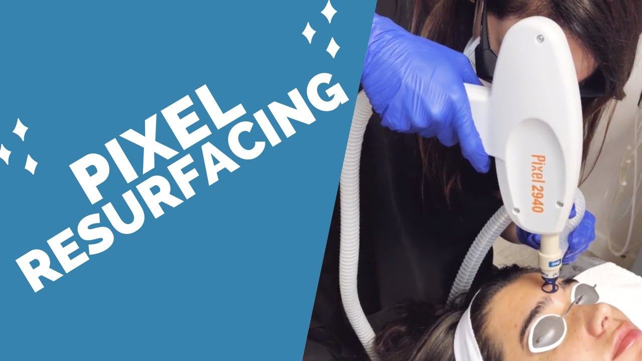 Pixel Resurfacing | Laser treatment that smooths wrinkles, acne scars, so much more! смотреть онлайн