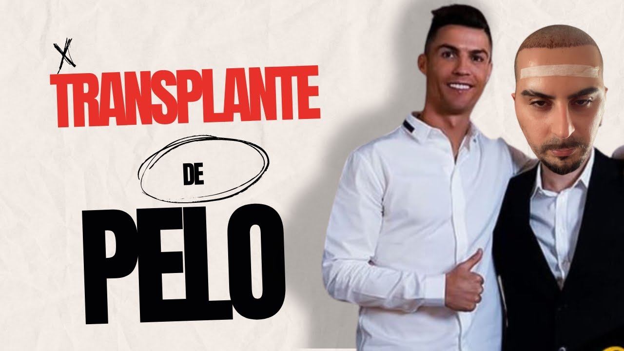 MI OPERACIÓN DE TRANSPLANTE CAPILAR | SE ME HINCHA LA CARA #1 смотреть онлайн