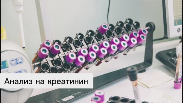 Анализ на креатинин
