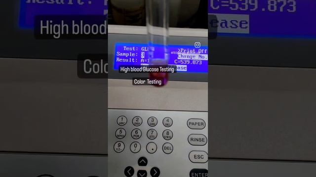 Blood sugar random .....colour testing methode #god#pod смотреть онлайн