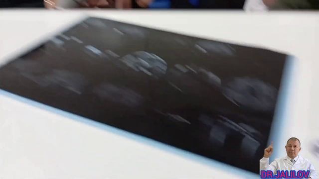 EPILEPSIYA TASHXISNI KIM QO‘YADI //NATIJALI TIBBIYOT [ PANKRORAYD ] смотреть онлайн
