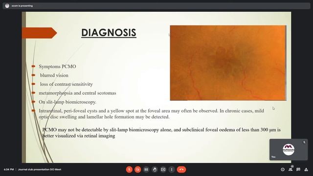 Cystoid Macular Edema Following Cataract Surgery A Review, Dr. Zeba Khanam, 18 July, 2022 смотреть онлайн
