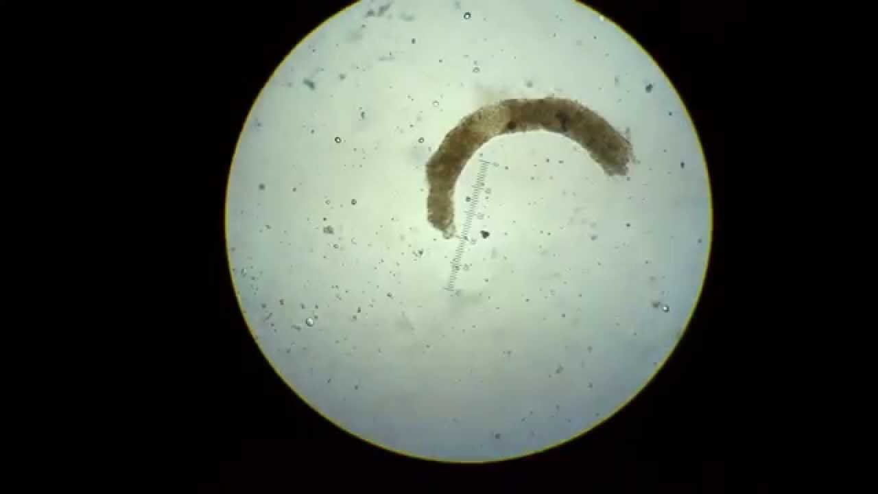 Euglena смотреть онлайн
