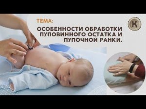 Как правильно обрабатывать пупочную ранку новорожденного