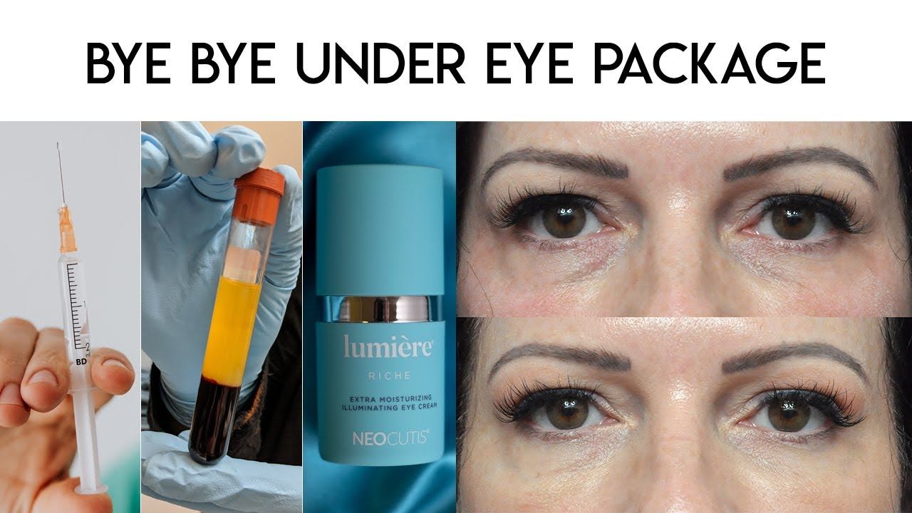 Bye Bye Under Eye смотреть онлайн