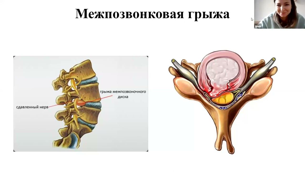 20240202 СЗ Ч 2 Преподавание Хатха, Крия, Мантра, Пранаяма Йоги Анатомия и Физиология смотреть онлайн