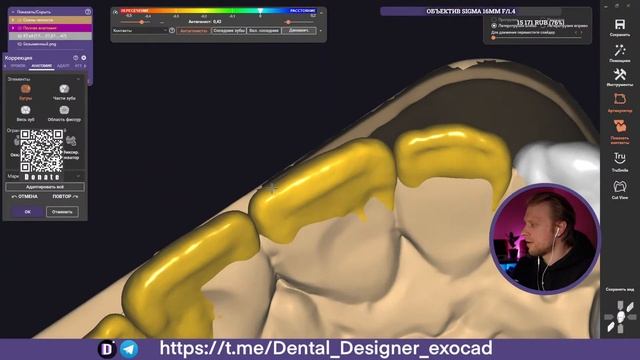 Exocad Stream / Моделировка Стоимостью 1500 за 1 еденицу/ Разбор ваших работ