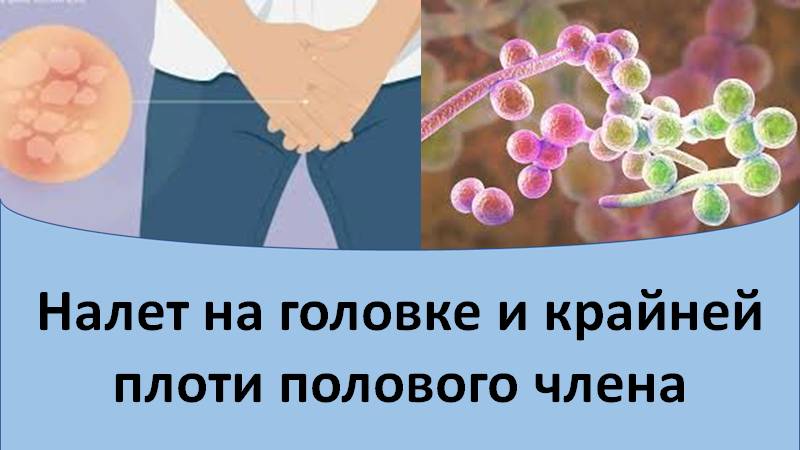 Налет на головке и крайней плоти полового члена смотреть онлайн