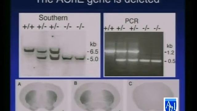 P Lein, PhD: Pesticides & ASD смотреть онлайн