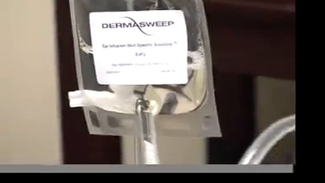 Derm Refresh - DermaSweep Facial Rejuvenation with Infusion смотреть онлайн