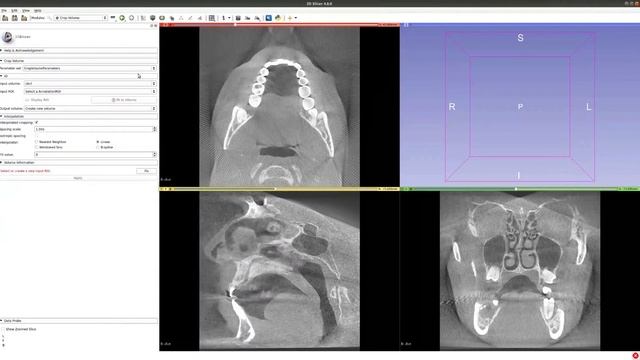Slicer 3D for Volumetric Image Segmentation/labelling - Basic segmentation usage смотреть онлайн