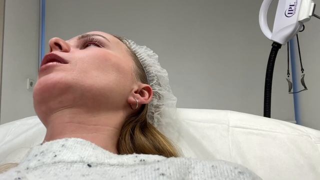 Что я сделала с лицом?|Инъекции|Сколько стоит?|Обзор клиники в Петербурге смотреть онлайн