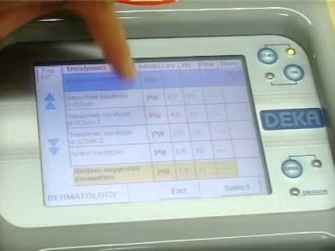 Лазерное омоложение лица DEKA смотреть онлайн