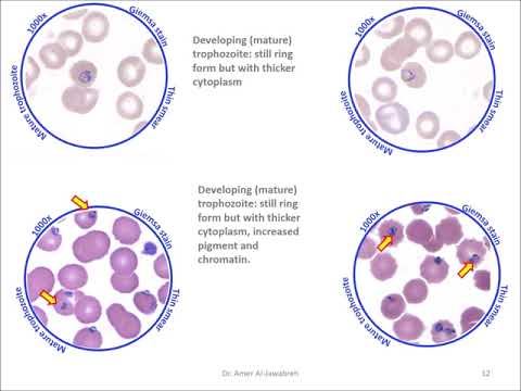 Malaria-2: Plasmodium falciparum stages смотреть онлайн