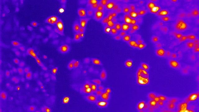Ca2+ influx into HaCaT cells - no treatment смотреть онлайн