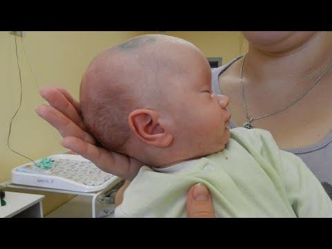 GIDROSEFALIYA // 4 KUN ICHIDA QANDAY NATIJA //O‘ZGARISHLAR YAXSHIMI //Dr.JALILOV смотреть онлайн