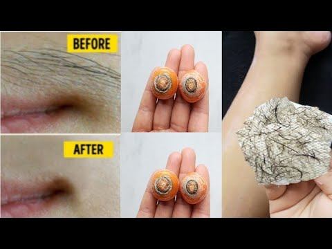 Stop shaving! This is the easiest way to get rid of facial and body hair forever смотреть онлайн