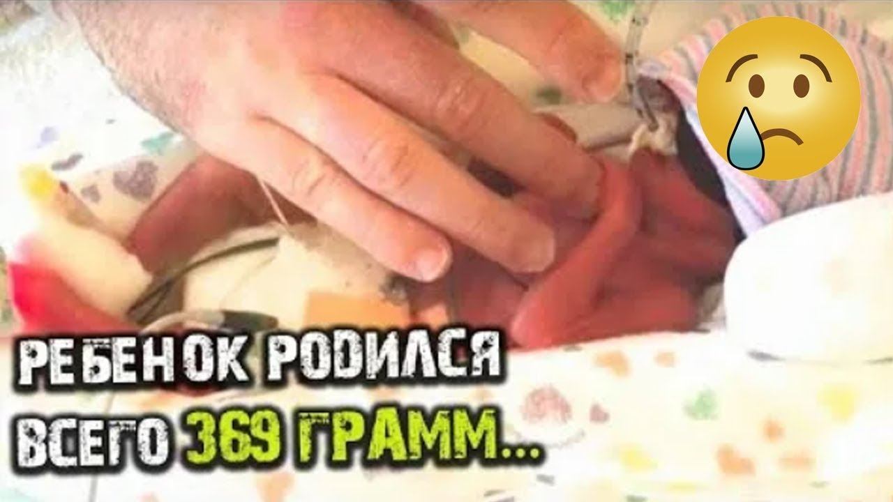Ребенок появился на свет с весом 369 грамм и мама всерьез думала, что он не выживет.. Но малыш смотреть онлайн