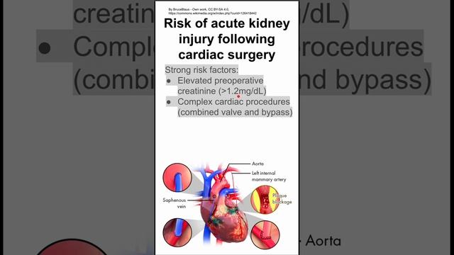 Risk of acute kidney injury following cardiac surgery смотреть онлайн