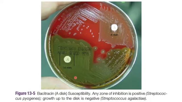 Cocos gram positivos: Algoritmo de identificación || Staphylococcus, Streptococcus, Enterococcus || смотреть онлайн