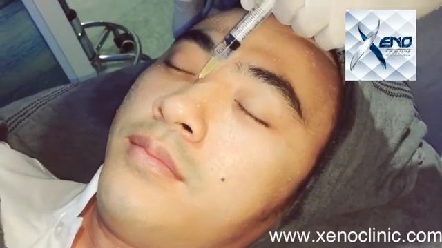 Meso white Lim chealay xeno clinic смотреть онлайн