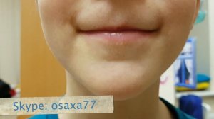 Слабый кончик языка. «Лошадка» не получается. Что делать? Этап 1