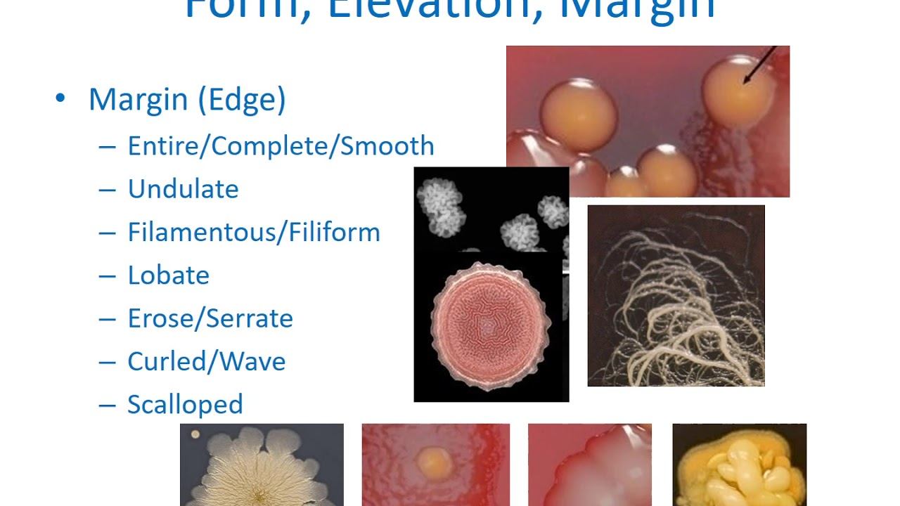 Topic F1 Part 1: Classification of Microorganisms 1: Archaea смотреть онлайн