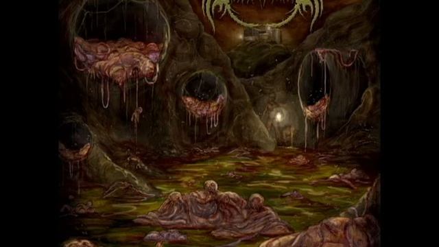 Blastomycosis - Clawhammer Hysterectomy смотреть онлайн